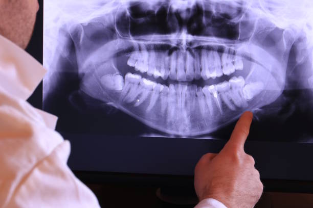Best Emergency Treatment for Dental Infections or Abscesses in Park Forest, IL